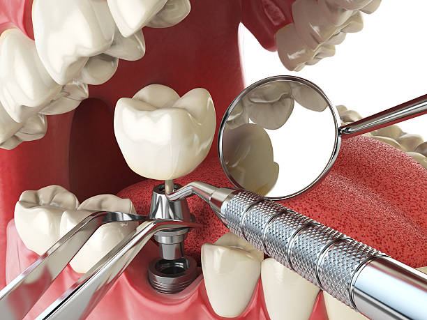 Best Emergency Cosmetic Dentistry (e.g., broken veneers) in Metuchen, NJ
